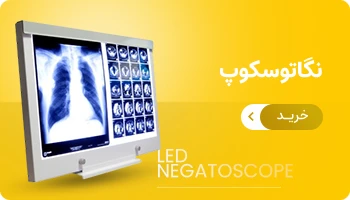 نگاتوسکوب