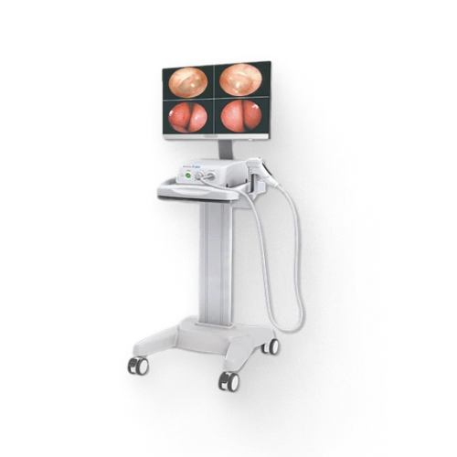 colposcope