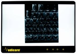 negatoscope-two-houses-medicare